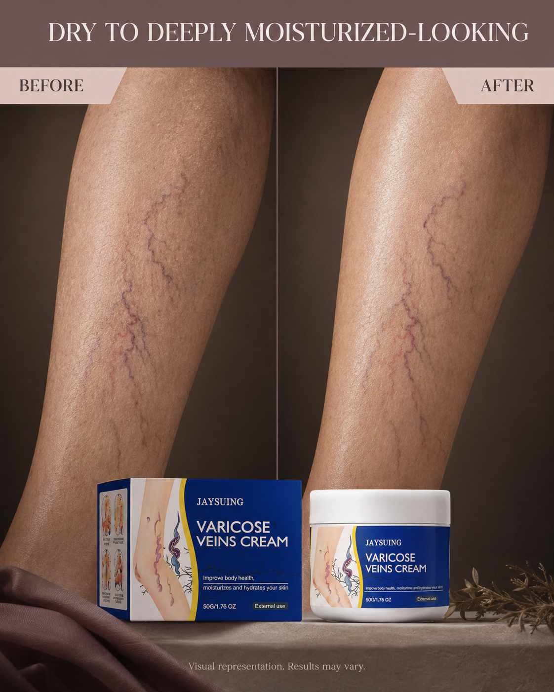 Varicose Veins Cream | Comforting Leg Massage & Skin Care Cream
